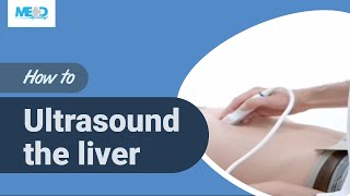 How to ultrasound the liver [upl. by Mckenzie]