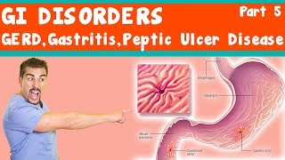 Small Intestinal Bacterial OvergrowthSIBO Steals Your Nutrients – DrBerg [upl. by Woodley257]