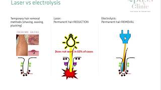 Laser hair removal vs Electrolysis [upl. by Mavis]