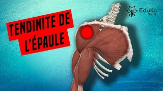 COMPRENDRE LA TENDINITE DE LÉPAULE Explications professionelles [upl. by Itraa]