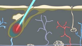 How Electrolysis Works Animation [upl. by Naggem904]