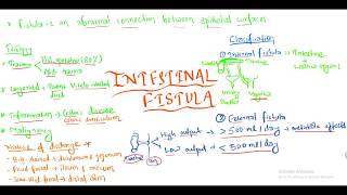 Intestinal Fistula [upl. by Avevoneg]