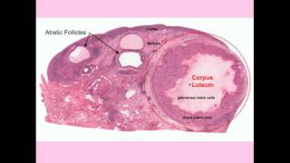 12DaysinMarch Ovarian Tumors for USMLE Step One [upl. by Trilly]